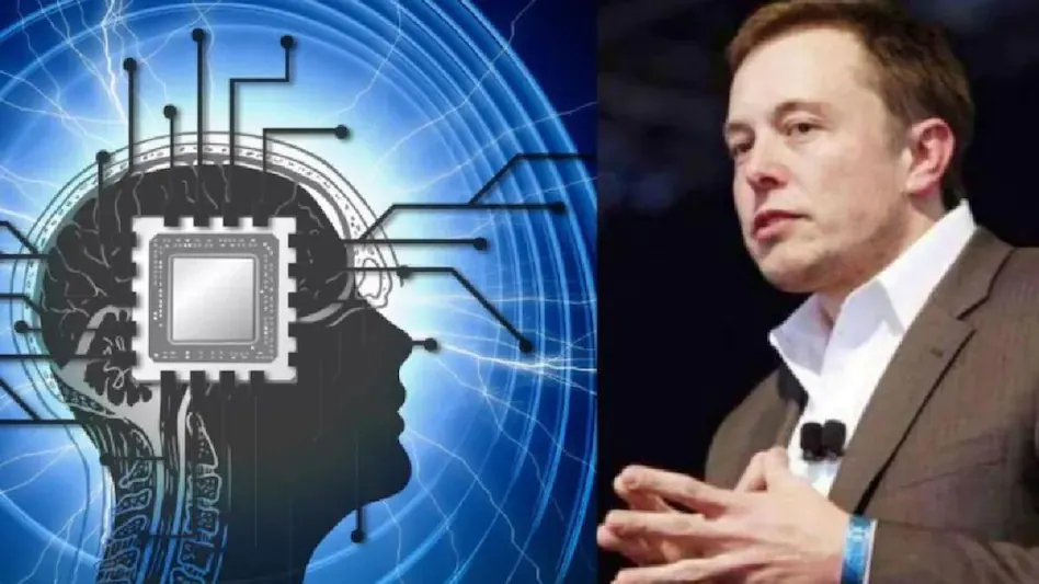 Elon Musk अपने दिमाग में लगवाएंगे ब्रेन चिप! जानिए क्या है Neuralink प्रोजेक्ट