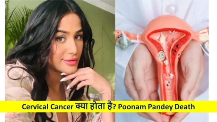 Cervical Cancer क्या होता है? Poonam Pandey Death News